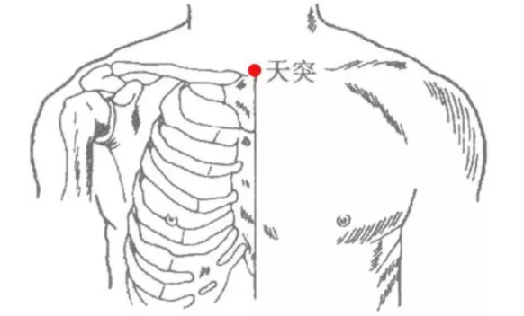 風(fēng)寒咳嗽怎么治？內(nèi)外兼修很管用