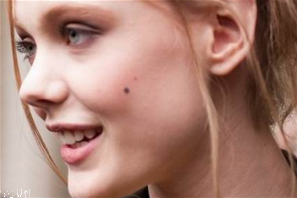 點痣的危害有哪些？激光點痣后的飲食禁忌