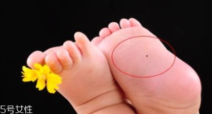 痣什么情況下會(huì)轉(zhuǎn)變?yōu)榱?？點(diǎn)痣不可取