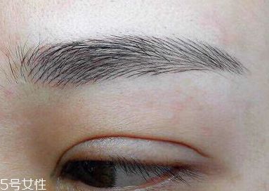 激光洗眉恢復(fù)期有疤痕怎么辦？激光洗眉毛之后正確護(hù)理方法