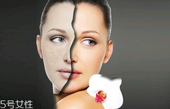 點(diǎn)痣的危害有哪些？激光點(diǎn)痣后的飲食禁忌