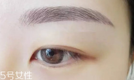 激光洗眉恢復(fù)期有疤痕怎么辦？激光洗眉毛之后正確護(hù)理方法