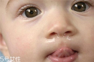 冬季寶寶流鼻涕是什么原因？教你幾招輕松應(yīng)對