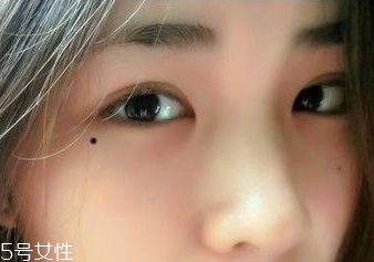 痣越多越長壽嗎？身上最有福氣的吉痣