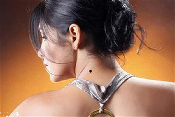 脖子后面有痣代表什么？10大身體缺陷是好事