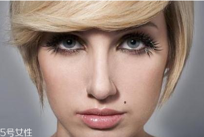 黑痣是怎么形成的？防范黑色毒瘤