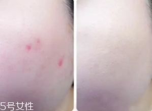 cpb遮瑕棒怎么樣？來(lái)看看使用效果