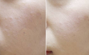 遮瑕棒能當(dāng)粉底用嗎？一物多用的遮瑕棒