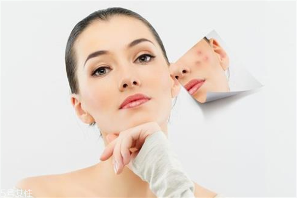 去胎記要多少錢？胎記去除后要做好護(hù)理