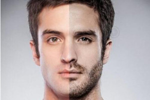 如何從男人的胡子看出疾病？胡子顏色是關(guān)鍵