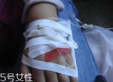 輸液治療不適合哪些??？過敏反應危害大