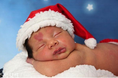 胎記長(zhǎng)在哪里有福氣？胎記的本質(zhì)是色素沉著