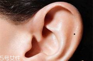 臉上哪些痣不能去掉？這些痣不能隨便祛掉