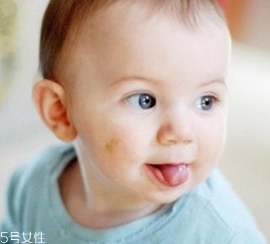 胎記怎么去除？胎記有遺傳的可能