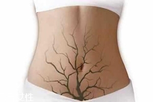 體內(nèi)毒素超標有何表現(xiàn)？五大癥狀須注意