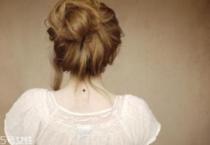 黑痣是怎么形成的？防范黑色毒瘤