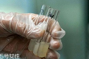 捐精有什么危害？專家稱沒有危害