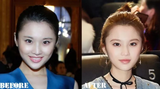 瑯琊榜2張慧雯整容了嗎？換了妝發(fā)美到不認(rèn)識(shí)