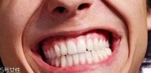 磨牙是因為受了委屈？孩子的心理狀況也會導(dǎo)致磨牙