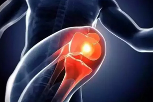 關(guān)節(jié)有響聲是病嗎？兩種情況區(qū)別對待