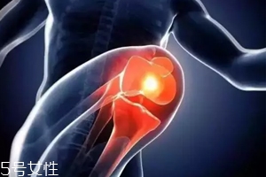 關(guān)節(jié)有響聲是病嗎？兩種情況區(qū)別對(duì)待