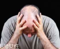 脫發(fā)有沒有治？只要不是禿子就有得治