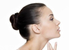 頸紋可以消除嗎？醫(yī)美方法最靠譜