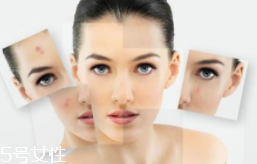 光敏食物真的會(huì)導(dǎo)致變黑嗎？只有敏感皮才要注意