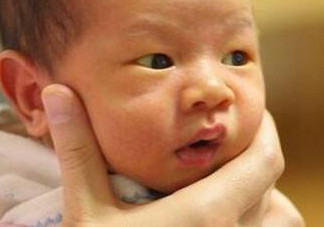 新生兒長(zhǎng)黃疸怎么辦？有些黃疸癥狀媽媽們可別忽視