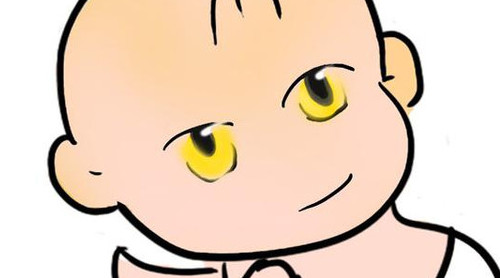 新生兒長(zhǎng)黃疸怎么辦？有些黃疸癥狀媽媽們可別忽視