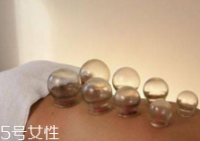 拔火罐引火上身的原因是什么？這4點(diǎn)要注意