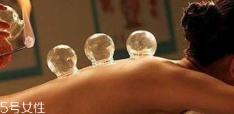 拔火罐引火上身的原因是什么？這4點(diǎn)要注意