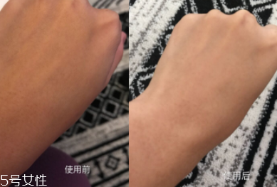 美白精華只能晚上用嗎？白天要做好防曬