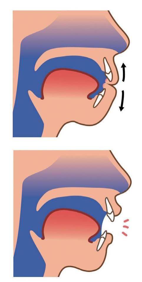 鼻塞怎么快速通氣 含溫水?dāng)[頭3分鐘 鼻塞怎么快速通氣 含溫水?dāng)[頭3分鐘
