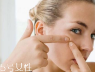 肌膚需要排毒嗎？長痘并不代表排毒