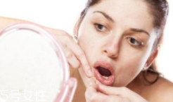 肌膚需要排毒嗎？長痘并不代表排毒