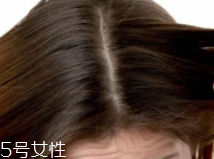 油性頭發(fā)跟什么有關(guān)？離不了這6個(gè)原因