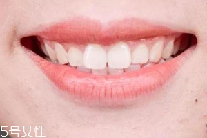 口紅病有哪些癥狀？使用不當(dāng)引發(fā)癌癥