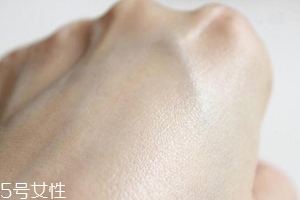 白癜風(fēng)與身體免疫功能有關(guān)系嗎？?jī)烧哧P(guān)系密切