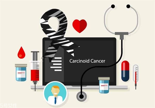 神經(jīng)內(nèi)分泌瘤近6成在胰腸胃 神經(jīng)內(nèi)分泌瘤近6成在胰腸胃