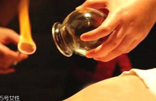 拔罐后身上后背持續(xù)發(fā)癢怎么回事？體內(nèi)風(fēng)邪是主因