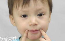 冬天爛嘴角什么原因？有可能營(yíng)養(yǎng)不良