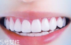 牙線和漱口水是否必要？抑菌護牙好習慣