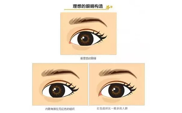 開外眼角和開內(nèi)眼角哪個好？開眼角有可能會回縮