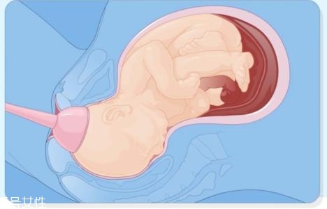 怎樣判斷自己能不能順產(chǎn) 判斷的3個依據(jù) 怎樣判斷自己能不能順產(chǎn) 判斷的3個依據(jù)
