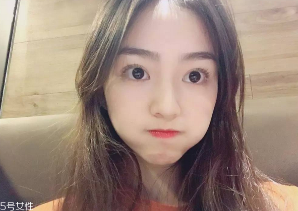 割雙眼皮要注意什么？割雙眼皮充血是正?，F(xiàn)象