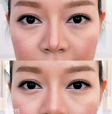 眉粉可以當(dāng)鼻影用嗎？眉粉這樣畫鼻影