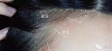 眉粉可以當(dāng)發(fā)際線粉嗎？解救高發(fā)際線的技巧