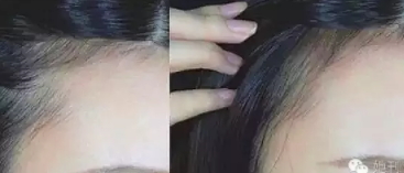 眉粉可以當(dāng)發(fā)際線粉嗎？解救高發(fā)際線的技巧