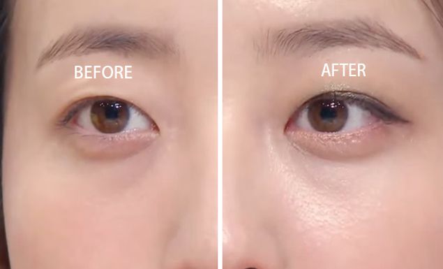 內(nèi)雙變外雙眼妝畫法 內(nèi)雙校正眼型方法 內(nèi)雙變外雙眼妝畫法 內(nèi)雙校正眼型方法